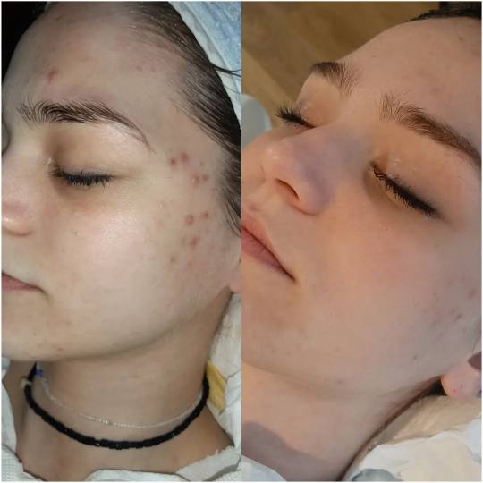 Elin Sary Mary Kutak #beograd Mlada, problematična koža lica je uvek bila moj izazov i moja ljubav