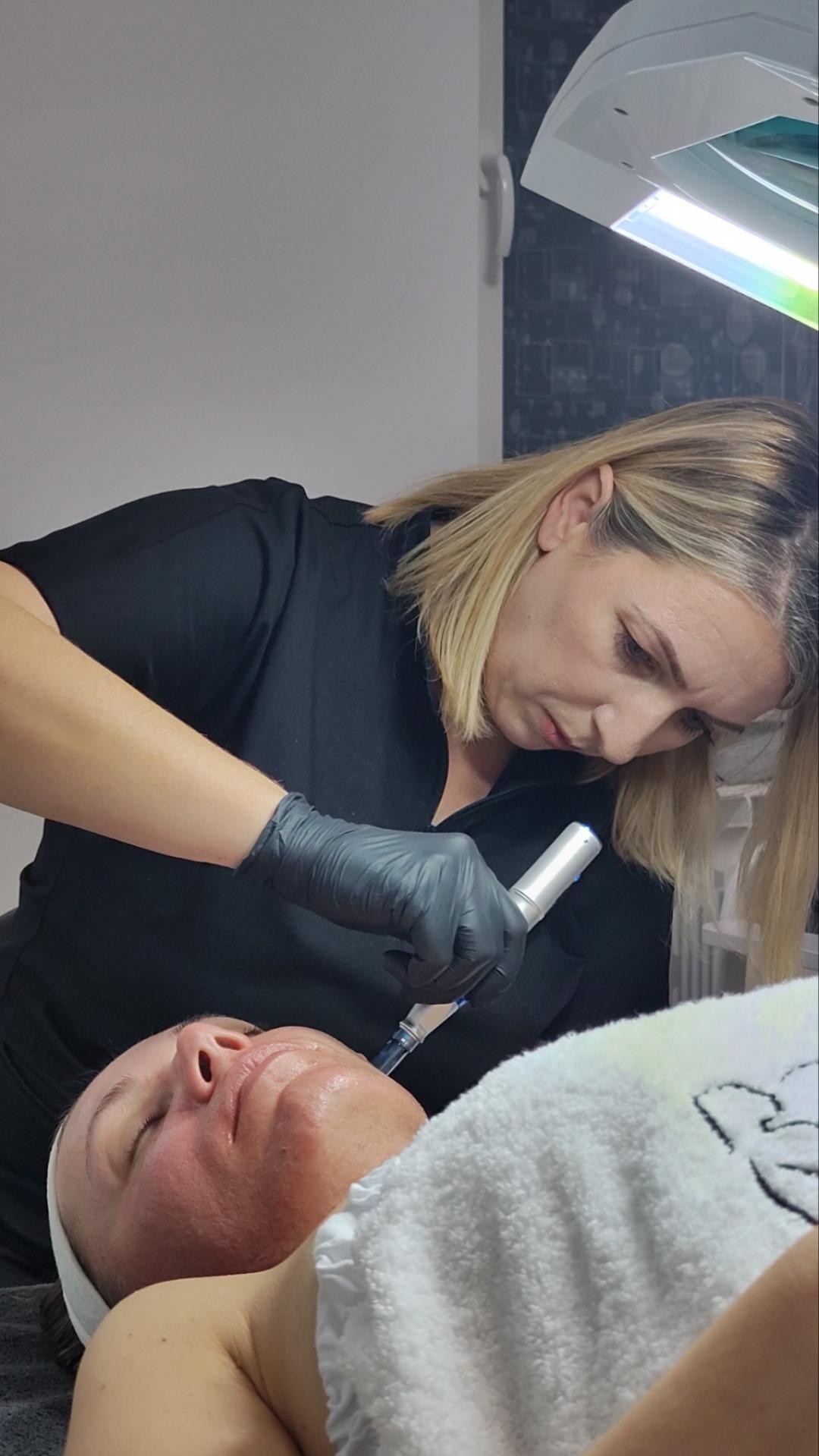 Skinpen-dermapen - Amelini beauty concept, Beograd Dermaroler i dermapen Lice Dermaroler i dermapen, Beograd, Zemun Centar