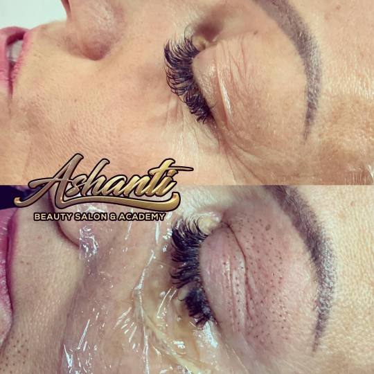 Ashanti Beauty Salon & Academy #beograd Tretman lica Plasma pen - gornji kapci