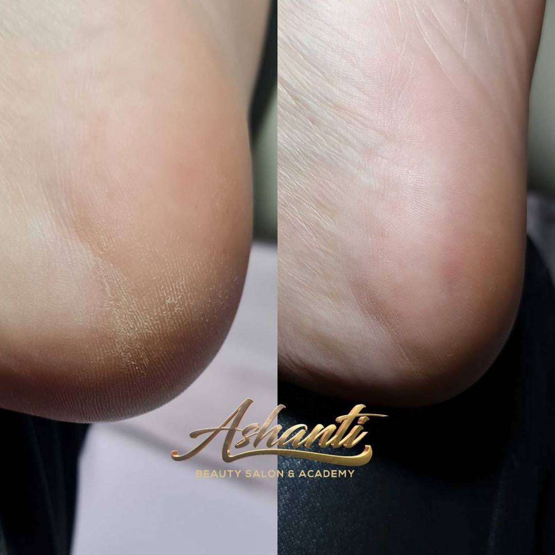 Ruski pedikir + lakiranje noktiju - Ashanti Beauty Salon & Academy, Beograd Estetski pedikir Nokti Estetski pedikir, Beograd, Voždovac