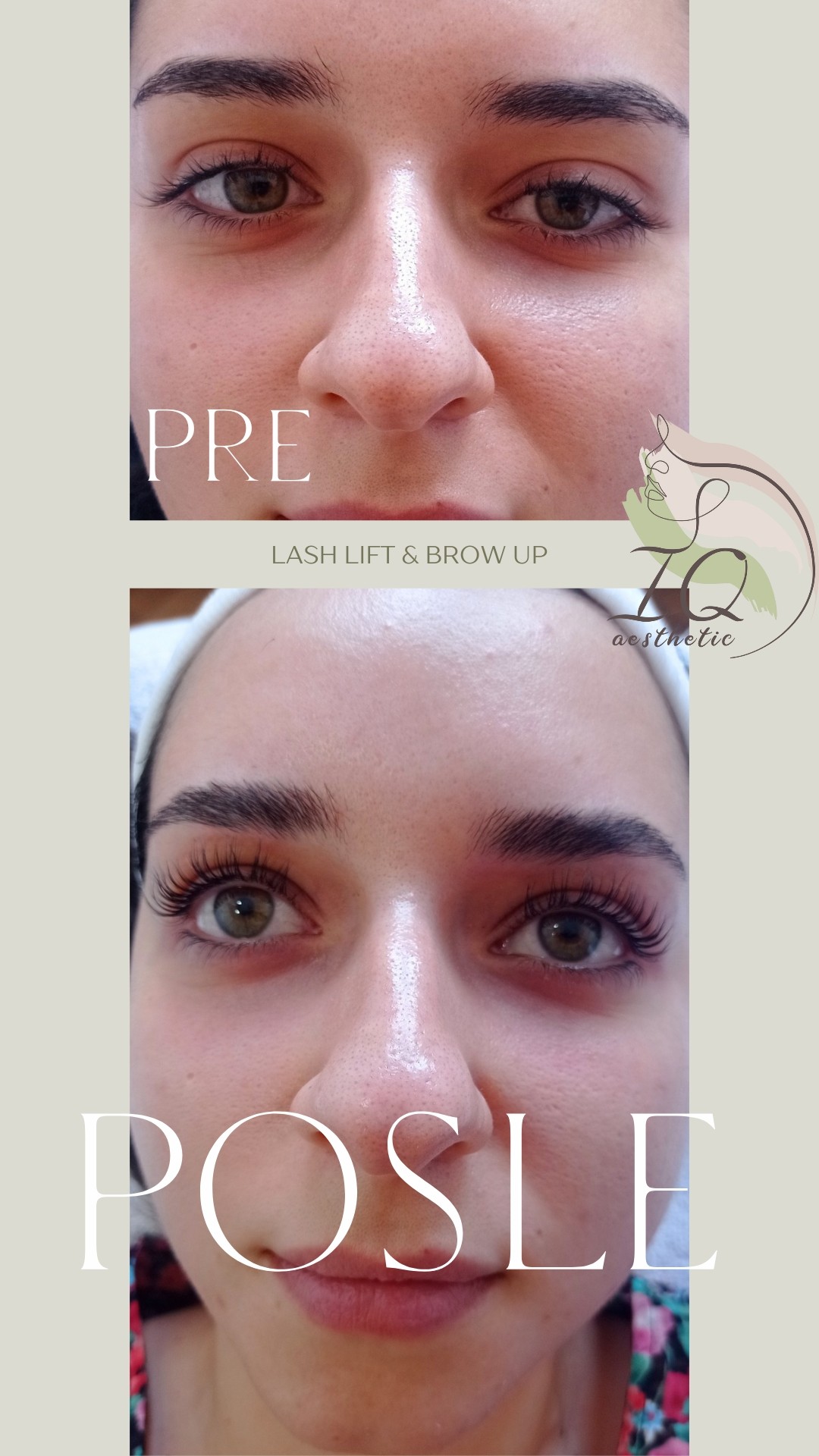 Lash lift + Brow lift - IQ aesthetic, Beograd Trepavice Lice Trepavice, Beograd, Karaburma, Višnjička banja