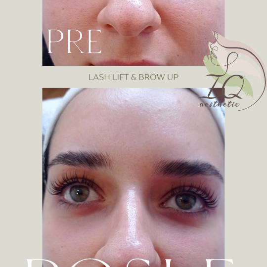 IQ aesthetic #beograd Trepavice Lash lift + Brow lift