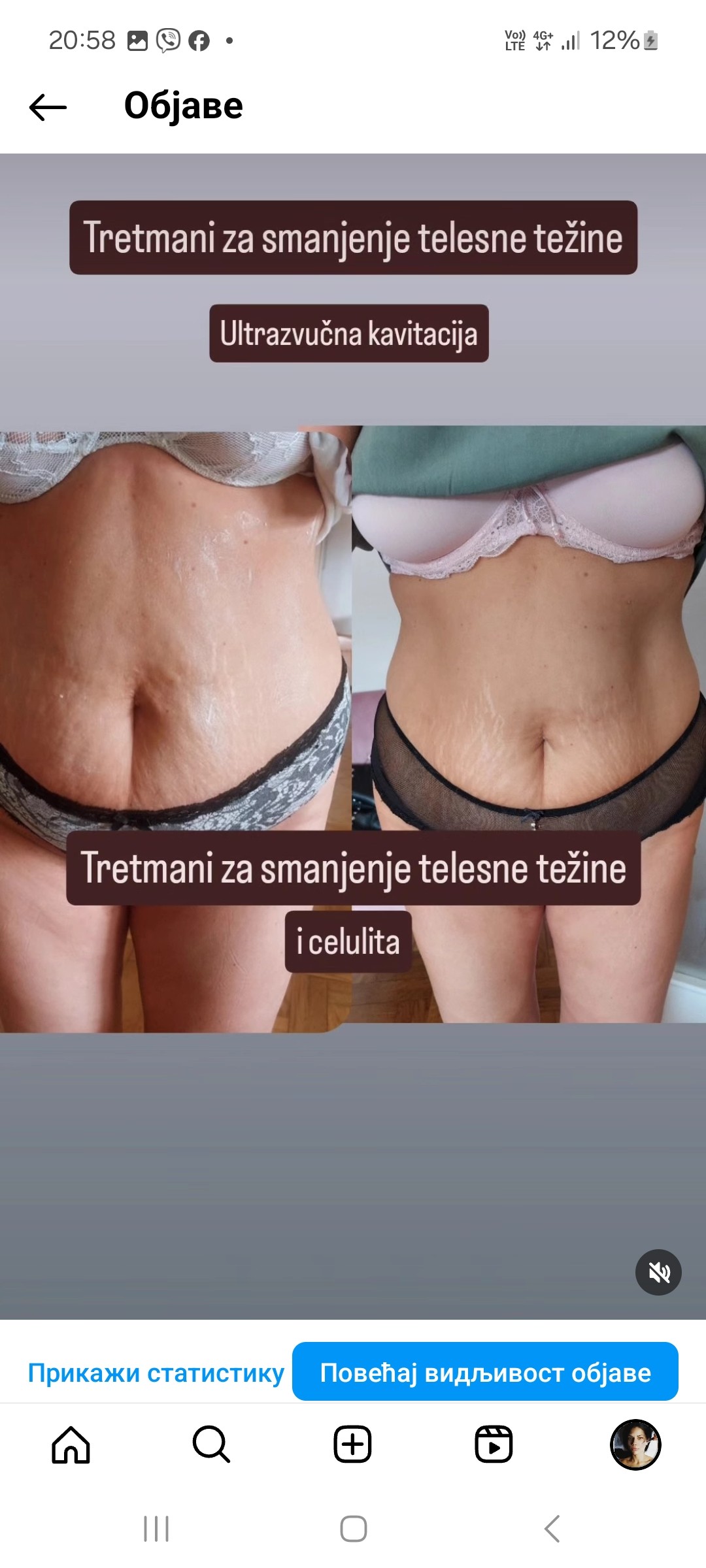 Anita M #novisad Kavitacija Ultrazvučna kavitacija - stomak
