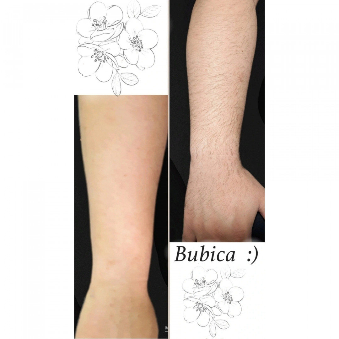 Bubica 22 #novisad Depilacija voskom Depilacija celih ruku hladnim voskom - za dame