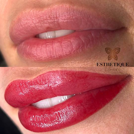 Esthetique Privé #beograd Trajna šminka Trajna šminka usana - PHILIPPS