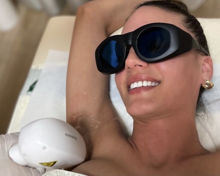 Epilon S #beograd Laserska epilacija Laserska epilacija pazuha - za dame