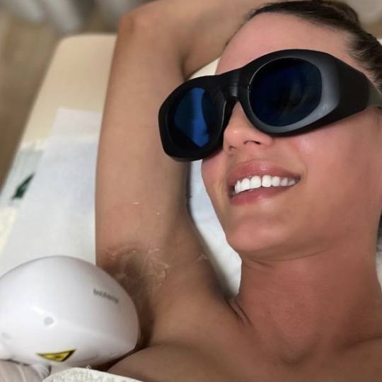 Epilon S #beograd Laserska epilacija Laserska epilacija pazuha - za dame