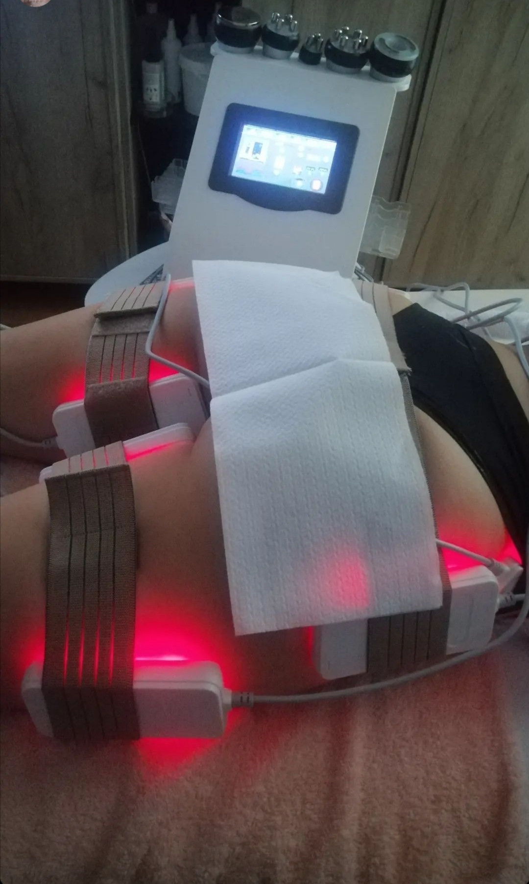 Lipolaser Centar - Matrix021 #novisad Tretmani tela