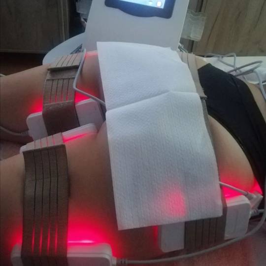 Lipolaser Centar - Matrix021 #novisad Tretmani tela 👉Neinvazivna liposukcija Diodnim laserom, zat