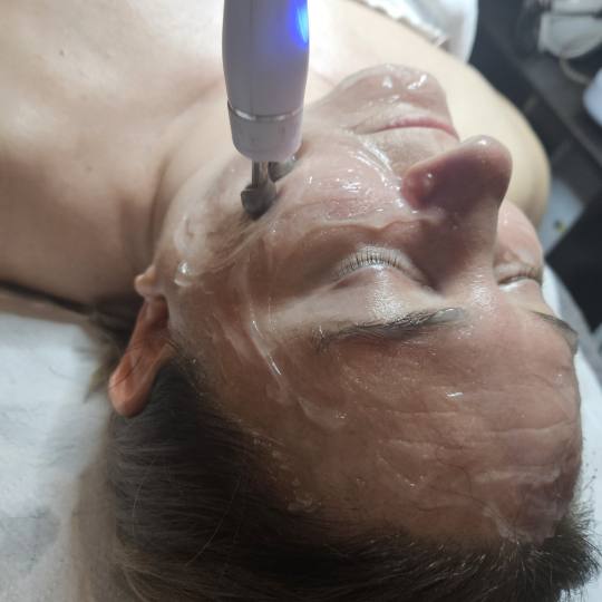 Ogledalce Starmedic #beograd Tretman lica RF lice Radiotalasni lifting lica, antiage tretman 
Daje 