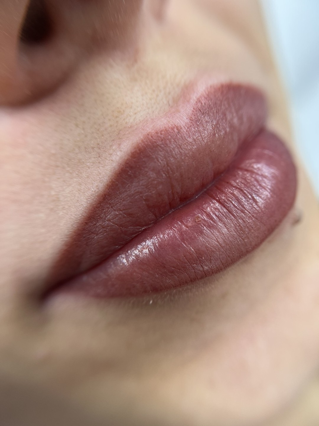 Esthetique Privé #beograd Trajna šminka Trajna šminka usana - PHILIPPS