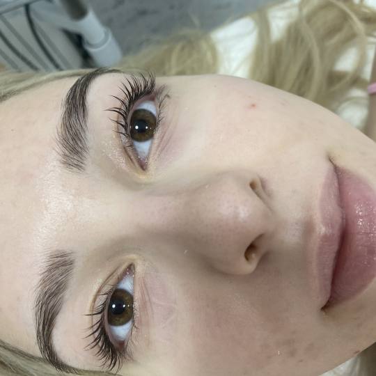 Mediva Estetik #beograd Trepavice Lash lift