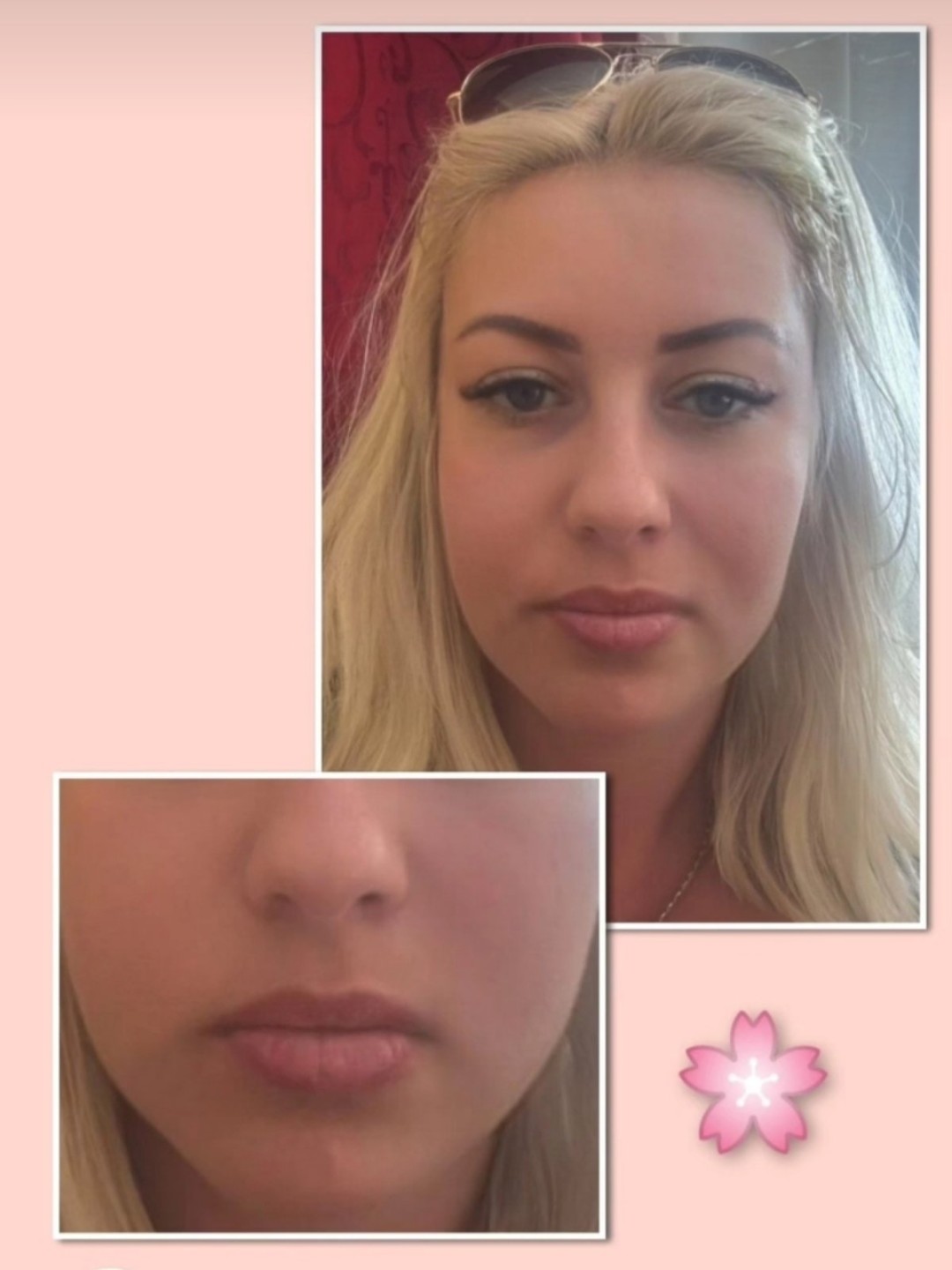 ReGenesis - Vidikovački venac #beograd Trajna šminka Trajna šminka usana - Libelino lips