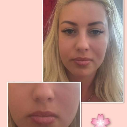 ReGenesis - Vidikovački venac #beograd Trajna šminka Trajna šminka usana - Libelino lips
