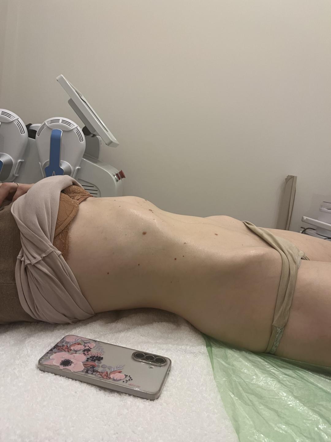 Vacum 65 body + limfna drenaža - Diamond beauty, Beograd Anticelulit masaža Masaža Anticelulit masaža, Beograd, Zemun Centar