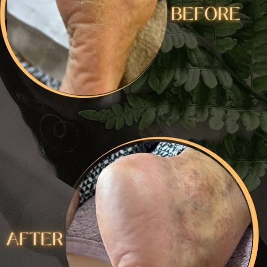 Aj Beauty Centar #pancevo Estetski pedikir KART Pedikir - kompletna obrada stopala