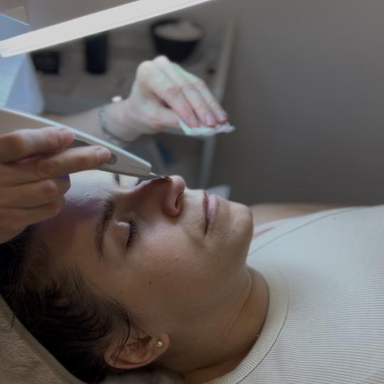 Sandra estetik studio #beograd Radiotalasni i ultrazvučni tretmani Ultrazvučna špatula Hvala na p