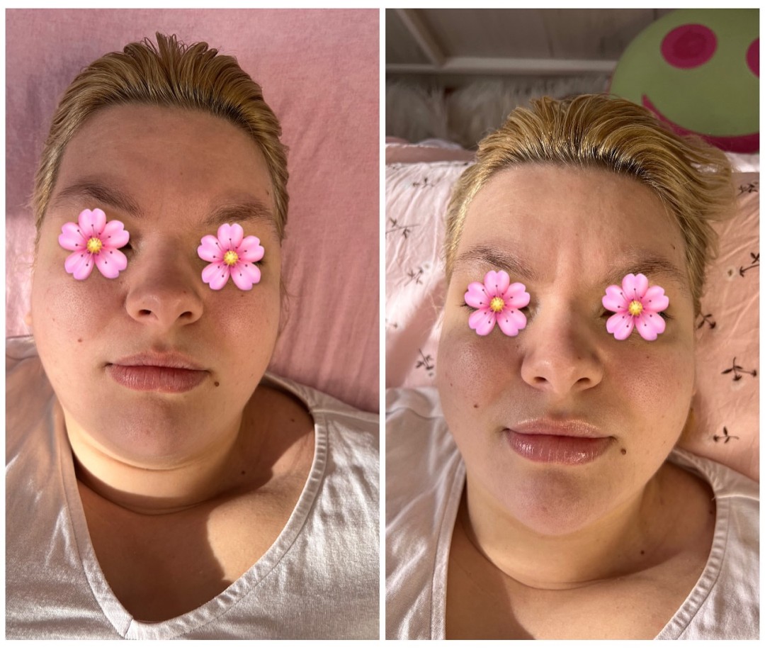 Glam&Glow #beograd Tretman lica Tretman za hidrataciju kože lica