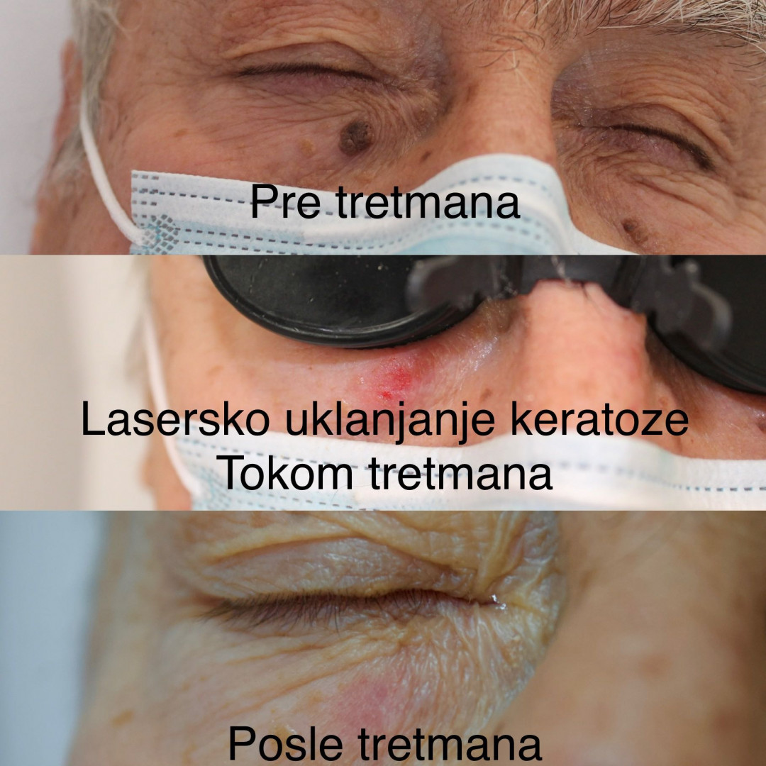 Poliklinika Marić #novisad Tretman lica Dermatološki pregled