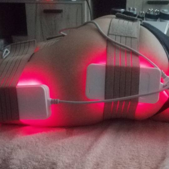 Lipolaser Centar - Matrix021 #novisad Tretmani tela 👉Neinvazivna liposukcija Diodnim laserom, zat