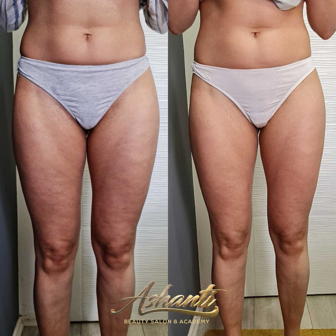 Ashanti Beauty Salon & Academy #beograd Masaža za mršavljenje Premijum maderoterapija