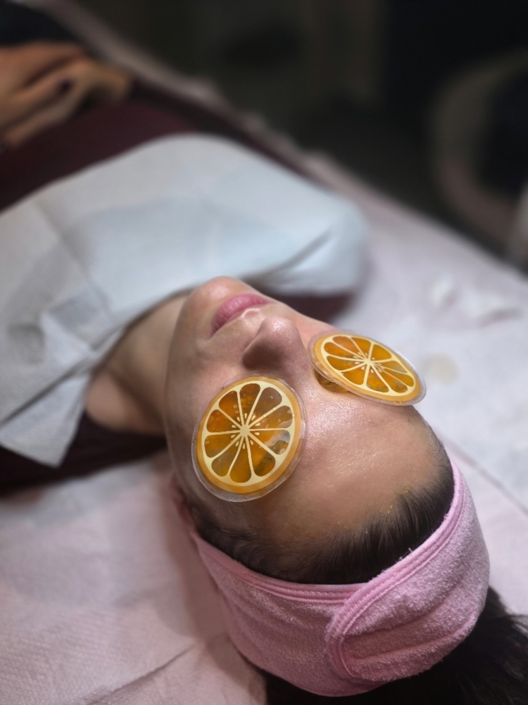 Hemijski piling lica - DNA - Starmedic, Beograd Akne Lice Akne, Beograd, Vračar, Čubura, Crveni krst