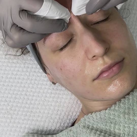 Estetski centar Đina #beograd Tretman lica Higijenski tretman lica