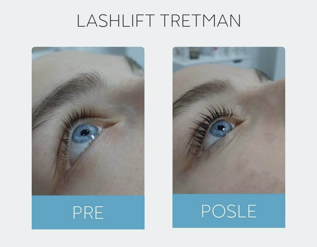 DepilConcept #beograd