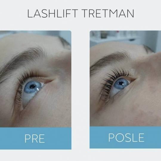 DepilConcept #beograd