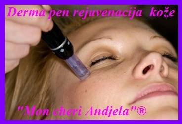 Mon cheri Anđela #beograd Dermaroler i dermapen