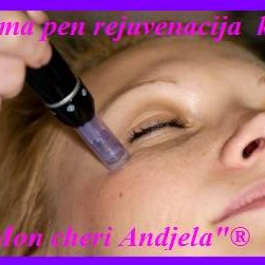 Mon cheri Anđela #beograd Dermaroler i dermapen Dermapen Dermapen tretman lica