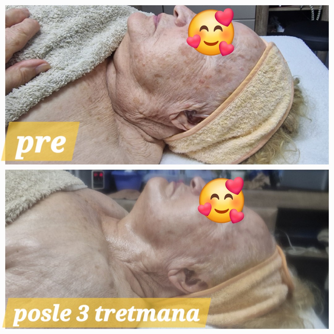 Fit limfomodelovanje lica - Seaside beauty, Beograd Opšta masaža Masaža Opšta masaža, Beograd, Novi Beograd Fontana, Tošin bunar