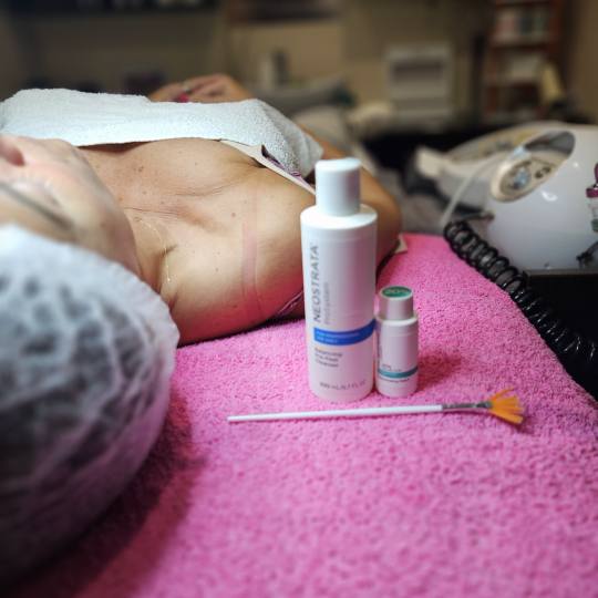 Starmedic #beograd Tretman lica Neostrata hemijski piling glikolnom kiselinom