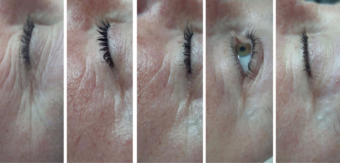 Look at me #beograd Tretman lica Eyelid booster