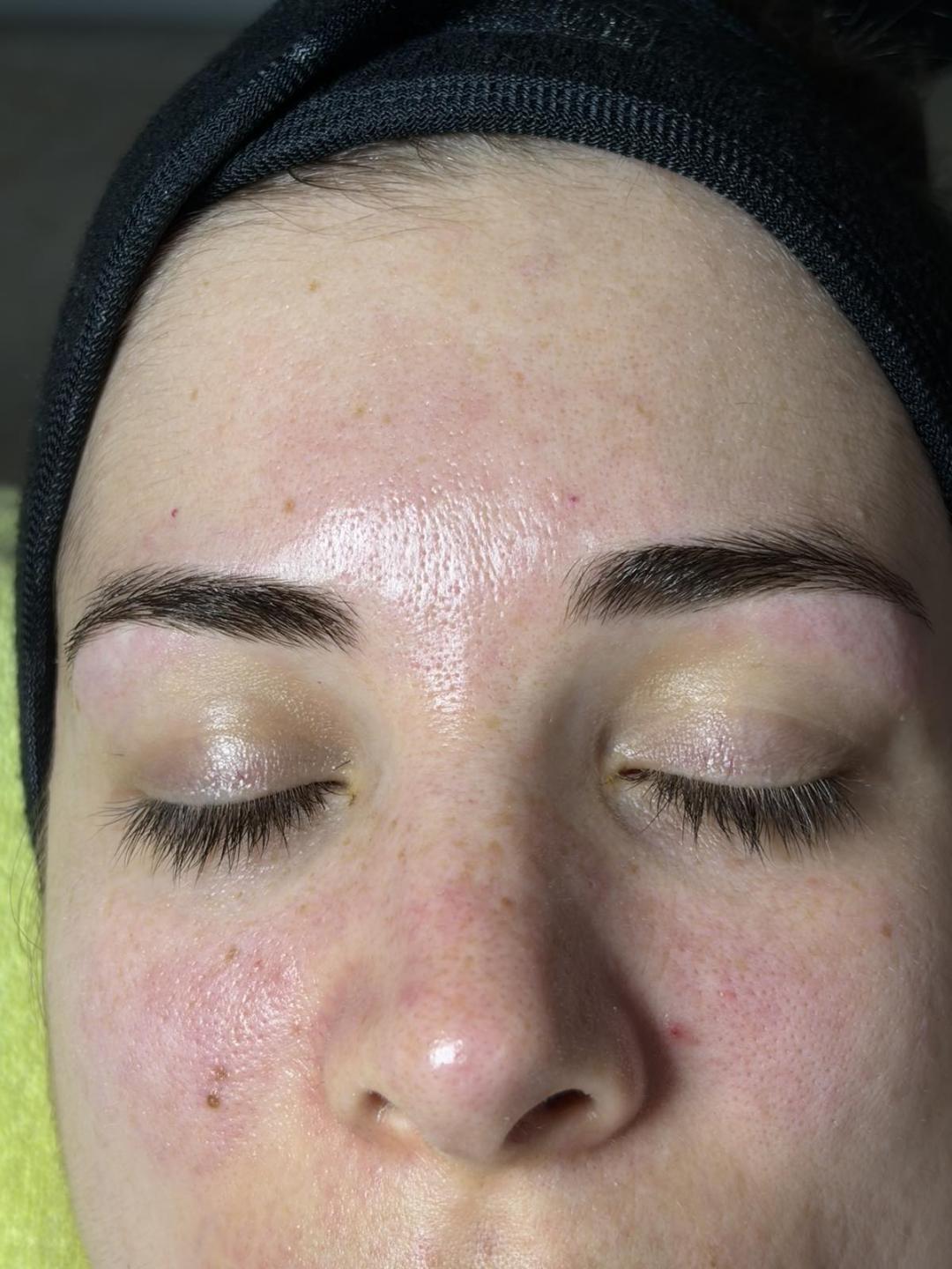 Higijenski tretman lica - Spago, Beograd Tretman lica Lice Tretman lica, Beograd, Centar, Stari grad, Dorćol