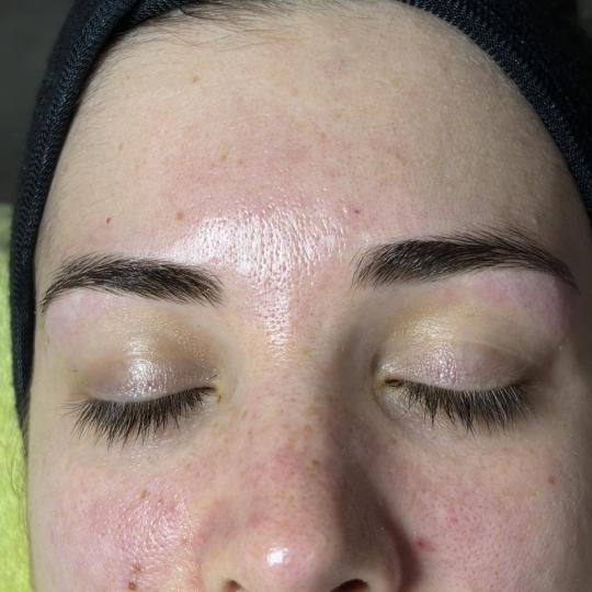 Spago #beograd Tretman lica Higijenski tretman lica