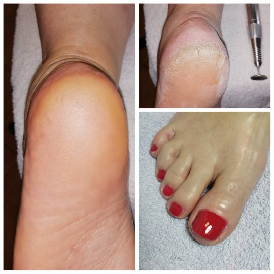 Mala Plava B #novisad Estetski pedikir Aparatni pedikir + gel lak Aparatni pedikir sa profi diskom +