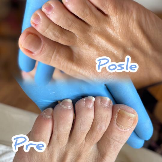 Beauty Dee #beograd Estetski pedikir Estetski aparatni pedikir