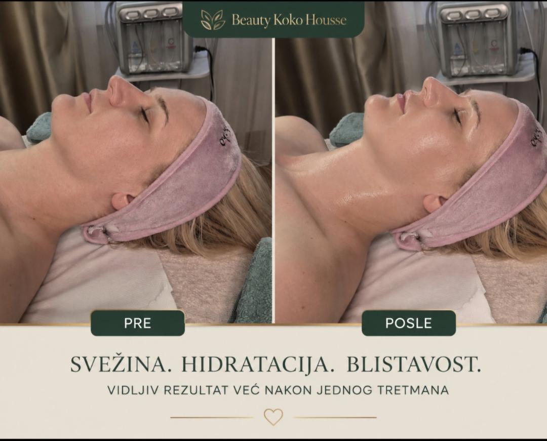 Higijenski tretman lica + hidratacija lica + oblikovanje obrva gratis + depilacija nausnica gratis - Beauty Koko Housse - Vračar, Beograd Tretman lica Lice Tretman lica, Beograd, Vračar, Čubura, Crveni krst