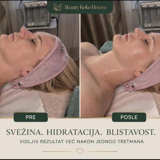 Beauty Koko Housse - Vračar #beograd Tretman lica Higijenski tretman lica + hidratacija lica + obli