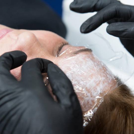 Ashanti Beauty Salon & Academy #beograd Tretman lica Plasma pen - horizontalne bore čela