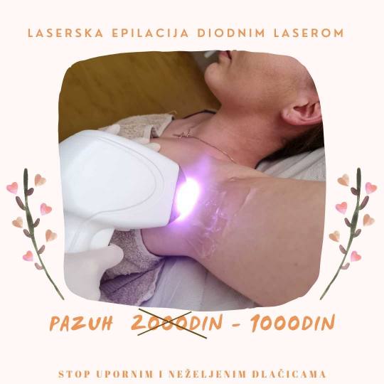 D&D Beauty Center #beograd Laserska epilacija Laserska epilacija pazuha - za dame
