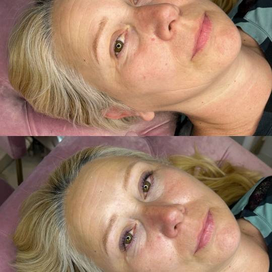 aBeauty Salon Lepote #beograd Trepavice Lash lift Oživite svoje trepavice uz glamurozni tretman pod
