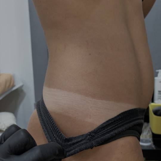 Mira 11 #beograd Air brush potamnjivanje kože Spray tan tretman