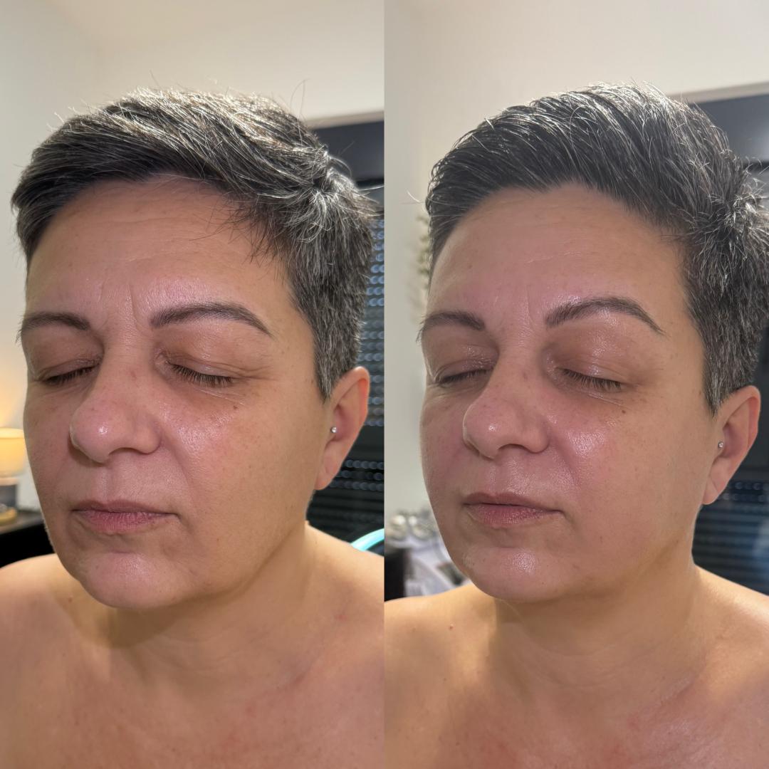 Kult #beograd Masaža lica Lifting masaža lica - Facial Workout