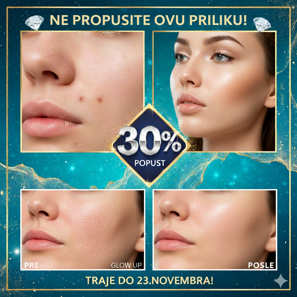 Higijenski trenam lica + Hidrodermoabrezija - Fresh Look, Beograd Lifting / zatezanje kože Lice Lifting / zatezanje kože, Beograd, Zvezdara