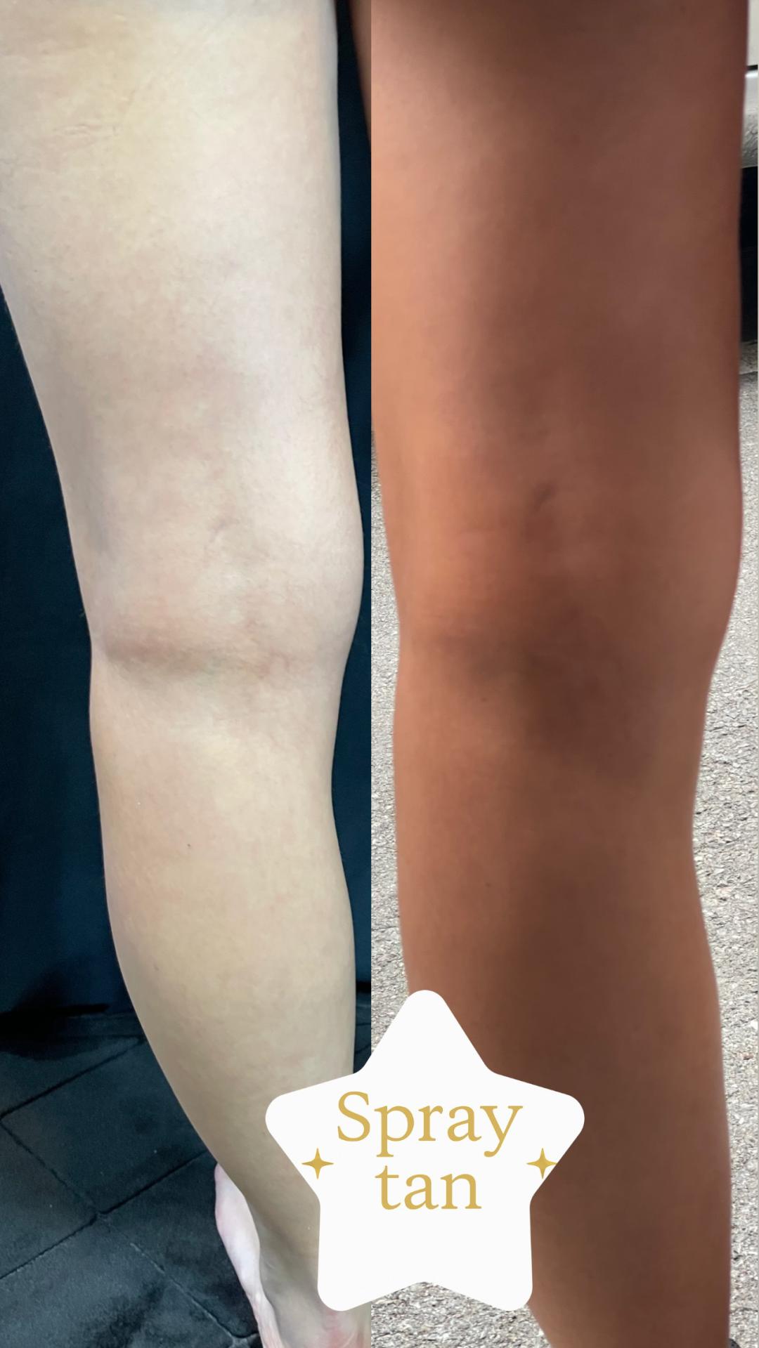 Lume Beauty #beograd Air brush potamnjivanje kože Sprej ten samopotamnjivanje - celo telo