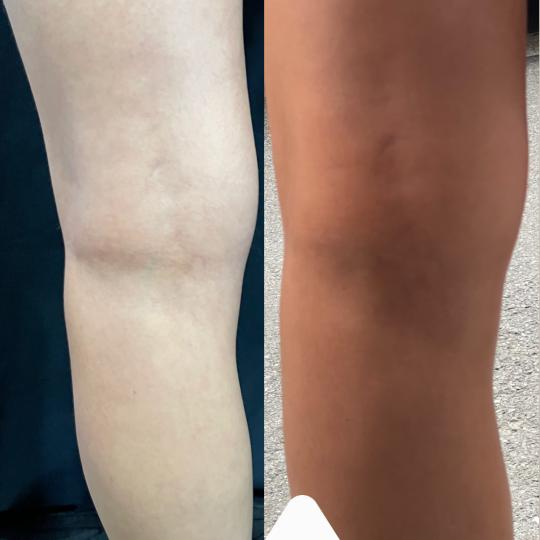 Lume Beauty #beograd Air brush potamnjivanje kože Sprej ten samopotamnjivanje - celo telo