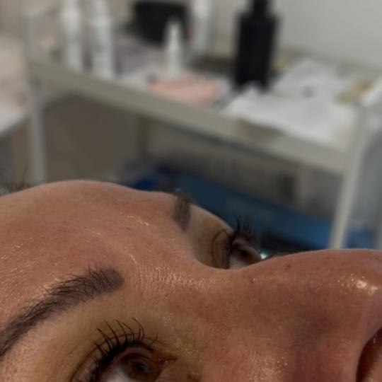 Sandra estetik studio #beograd Trepavice Lash lift + farbanje trepavica + botox Danas smo prirodnim 