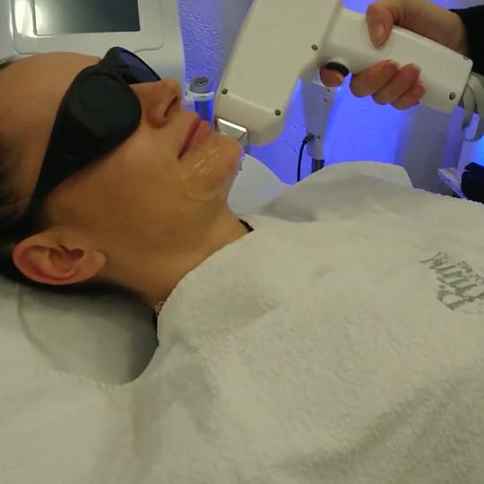 Laser lab by Ceca #novisad Laserska epilacija Laserska epilacija celog lica - za dame Tretman trajne